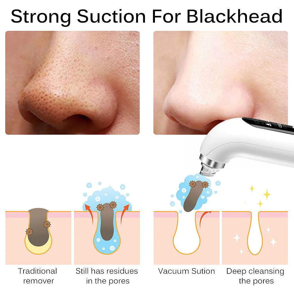 Blackhead Remover Pore Vacuum Face Cleaner