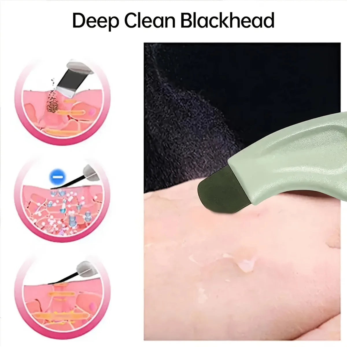 Nose Deep Facial Blackhead Removal Tool