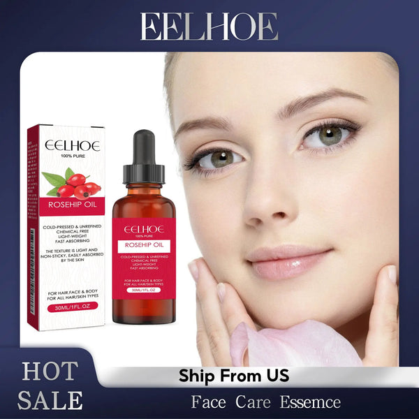 EELHOE Natural Organic Rose Hip Oil